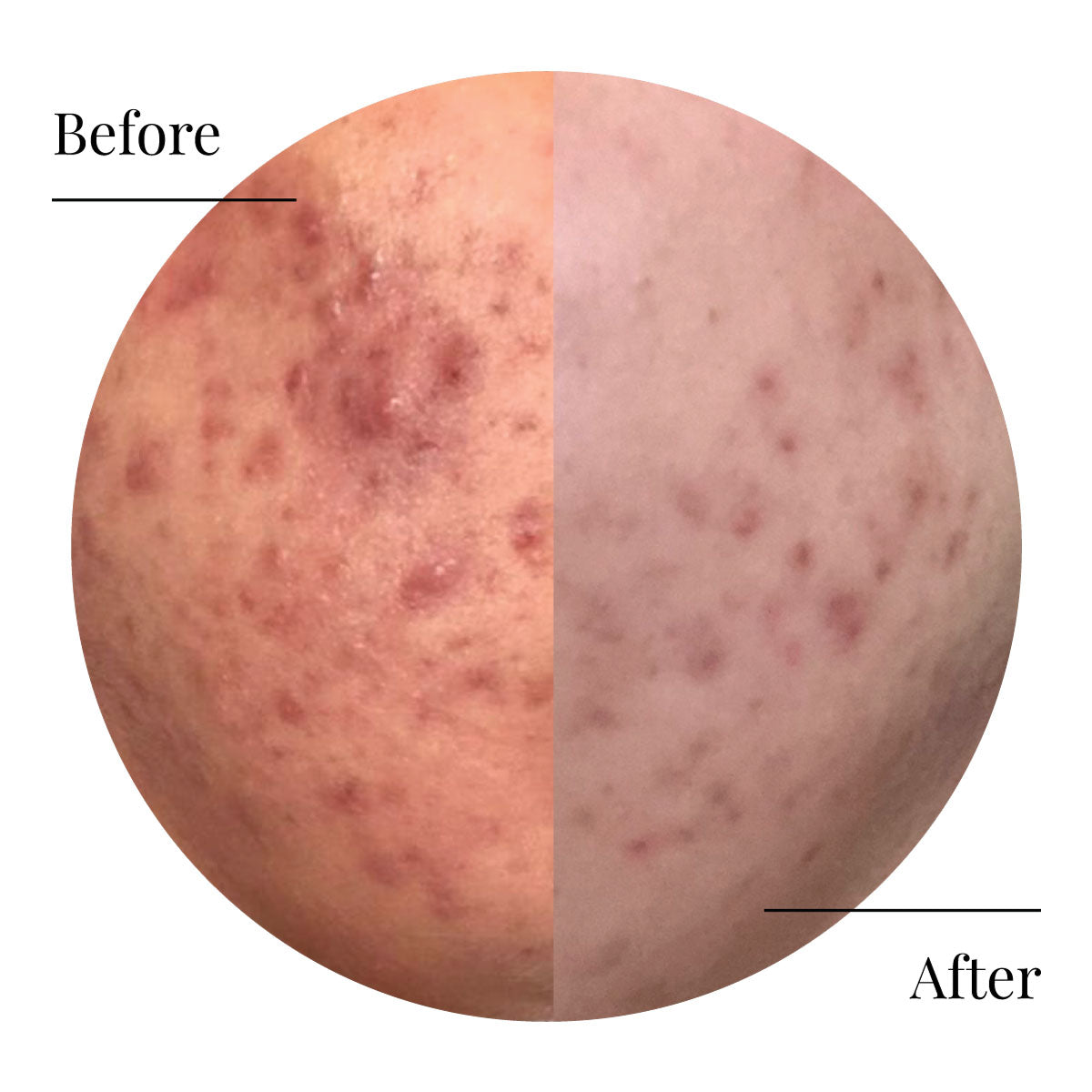 Face Care Products for Women